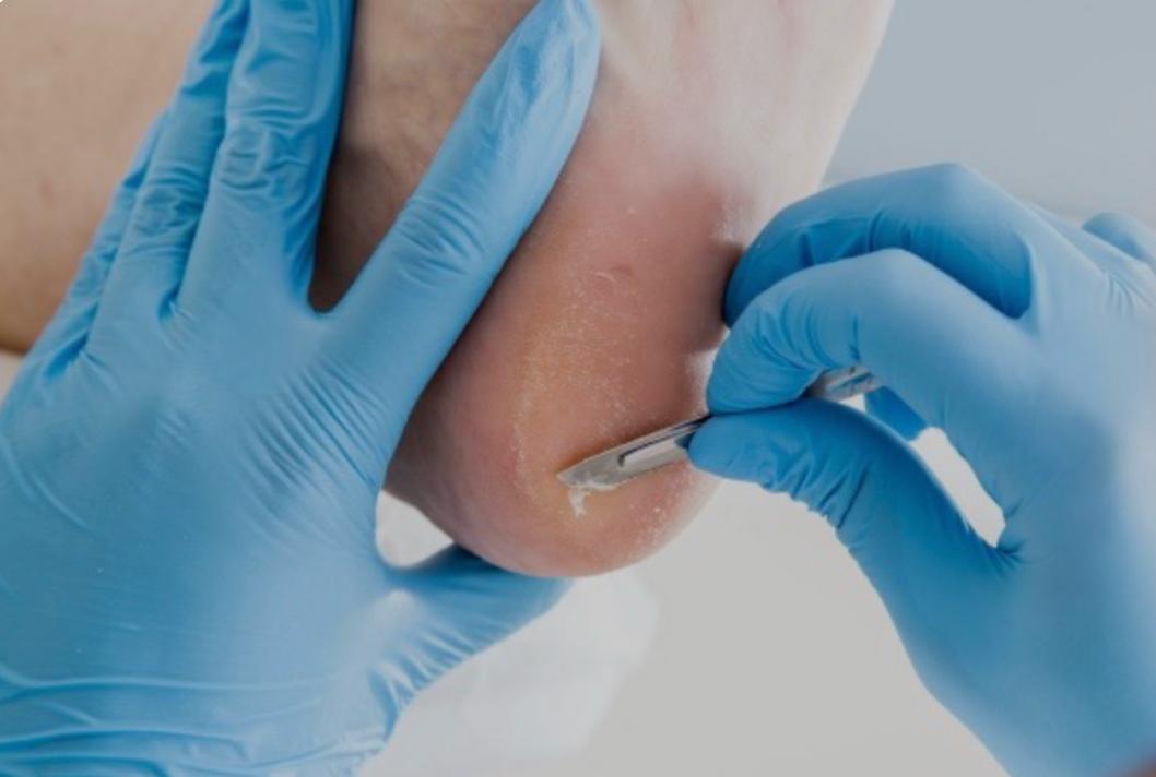 Professional foot care service